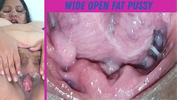 Fat And Hairy Woman Watch The Best Free Porn LetMeJerk