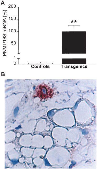 Pnmt Expression And Epinephrine Production In White Adipose Tissue A