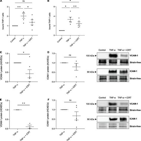 Inhibition of Wnt β catenin suppressed TNF α induced MCP 1 and IL 8