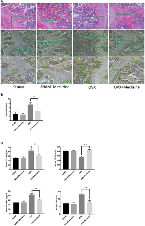 Frontiers Meclizine Prevents Ovariectomy Induced Bone Loss And