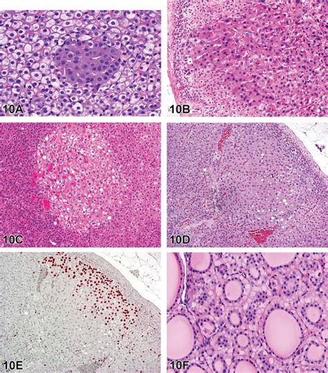 A C Illustration Of Focal Lesions In The Rat Adrenal Cortex A Download Scientific Diagram