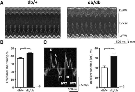 Echocardiographic Assessment Of Left Ventricular Structure And