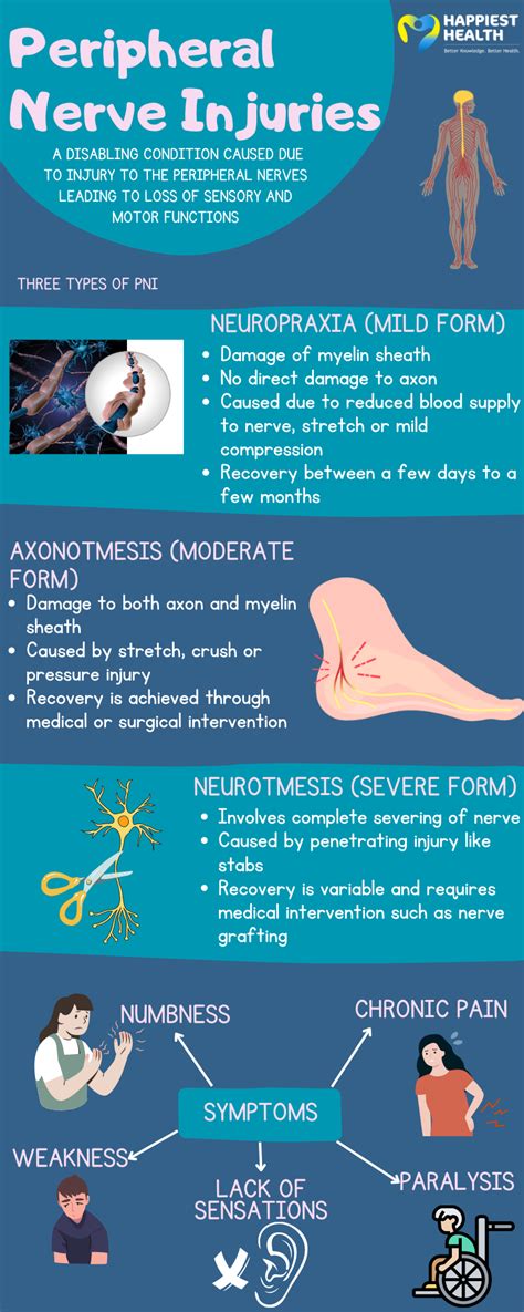 Types of peripheral nerve injuries | Happiest Health