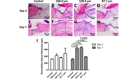 The Thickness Of The Granulation Tissue Following One Layer Scaffold Download Scientific