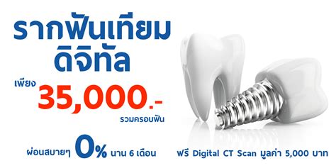 Dental Implants The Ivory Dental Clinic