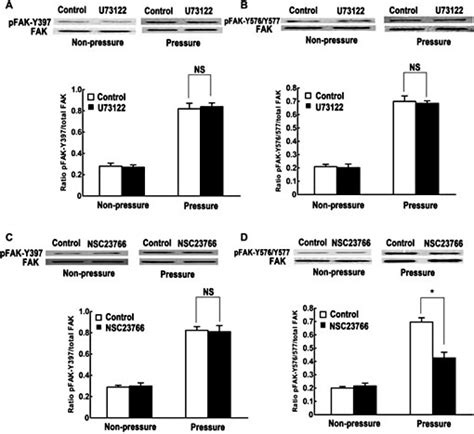 Effects Of Plcγ1 And Rac1 On Expression And Phosphorylation Of