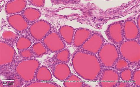 Histology Slides Database Thyroid Gland Histology Slides Hot Sex Picture