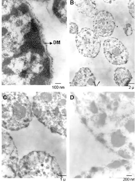 Electron Micrographs Of Nuclear Preparations A Control Rat Liver Cell