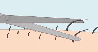 how to remove rectal hair