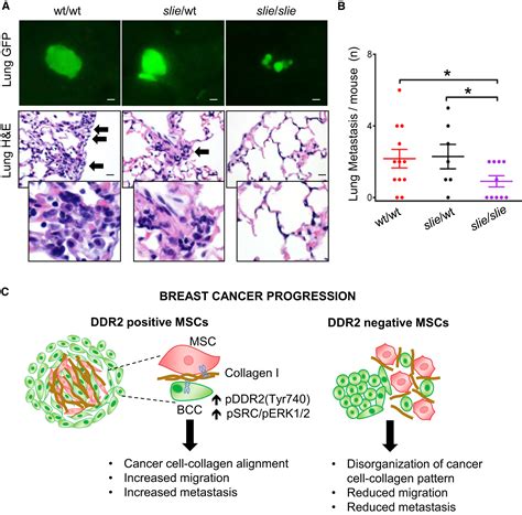 Mesenchymal Stem Cell Induced Ddr2 Mediates Stromal Breast Cancer