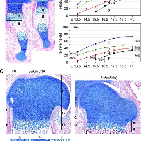 Reduced Hypertrophic Zone In 3na Growth Plates A Longitudinal