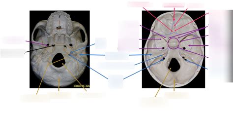 Axial skeleton: Skull 3 Diagram | Quizlet