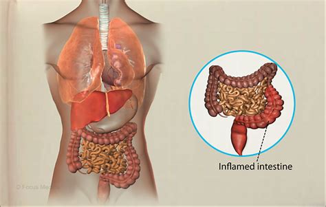 Health Condition Symptoms Causes Treatment And More