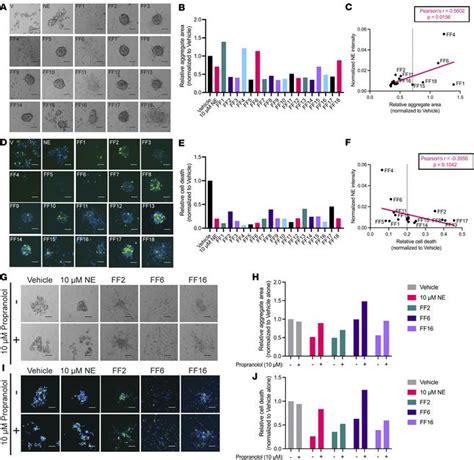 Jci Insight Norepinephrine Induces Anoikis Resistance In High Grade