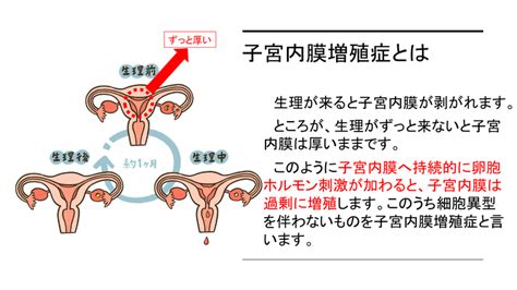 「子宮内膜増殖症」 津田沼ivfクリニック Tsudanuma Ivf Clinicのブログ