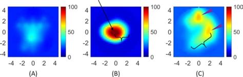 Prospective Assessment Of Adjunctive Ultrasound Guided Diffuse Optical