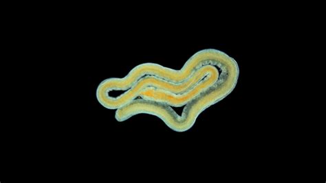 worm under microscope long like parasitic Stock Footage Video (100% ...