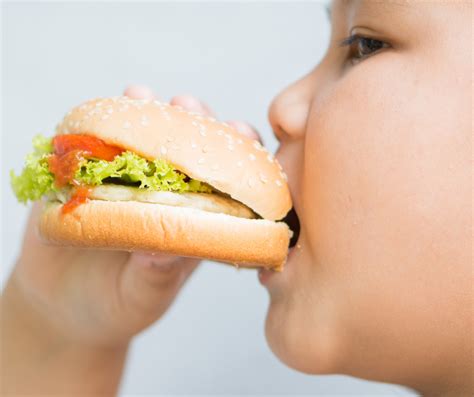 Obesidade Infantil Veja As Causas E Como Prevenir Esse Problema