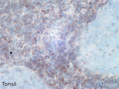 BCL2 Rat Monoclonal Clone NOR235J EuroMAbNet