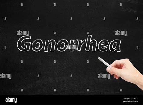 Gonorrhea Hi Res Stock Photography And Images Alamy