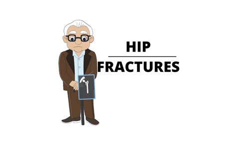 Hip Fractures Types And How To Treat Them Pro Doctor