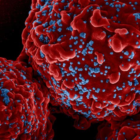 long quest  hiv vaccine  studies offer   path stat