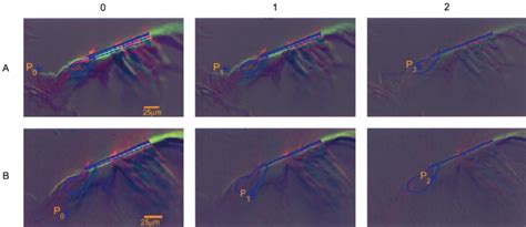 Determination Of The Effective Pivot Axis Of The Reticular Lamina