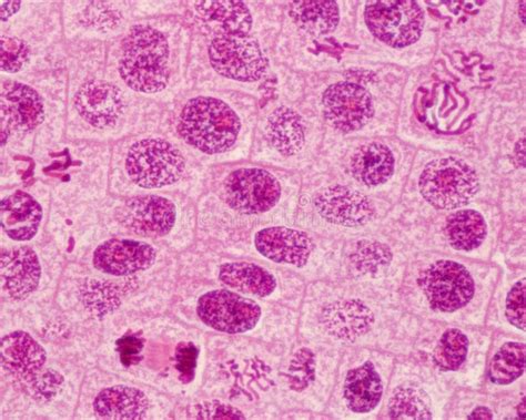 Mitosis Prophase Microscope