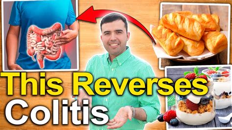 How To Treat Ulcerative Colitis Foods And Natural Remedies To Cure Ulcers In The Colon Youtube