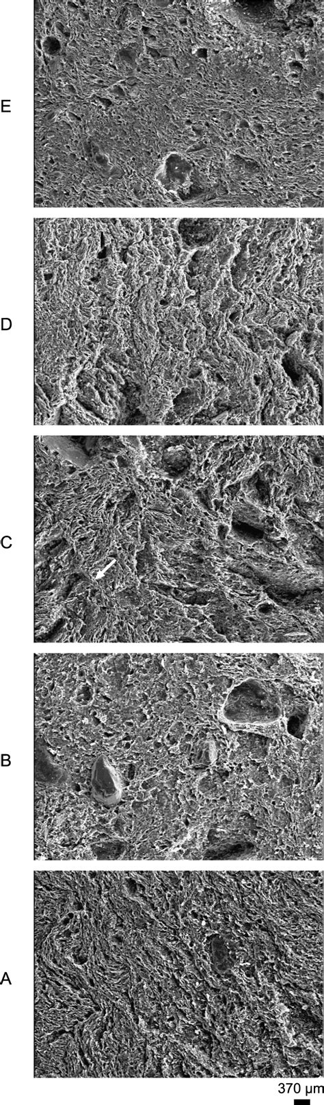 Images Observed In The Scanning Electron Microscope Arrangement Of