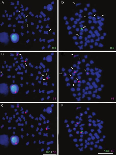 Fluorescence In Situ Hybridization With 18S RDNA A And D And 5S RDNA