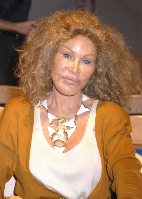 A aparência de Jocelyn Wildenstein conhecida como Mulher Gato antes