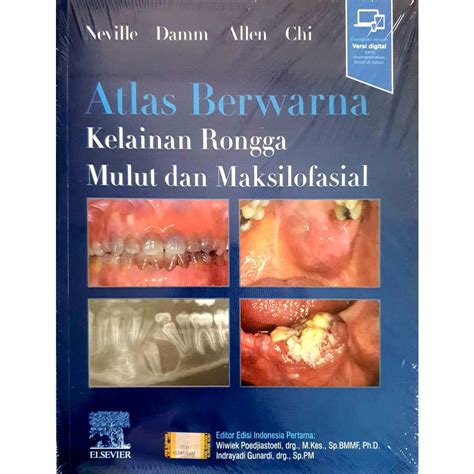 Jual Atlas Berwarna Kelainan Rongga Mulut Dan Maksilofasial Neville