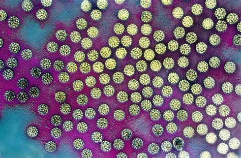 Human Papilloma Virus - Stock Image - M050/1003 - Science Photo Library