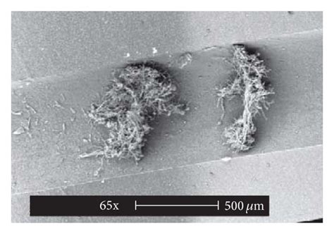Scanning electron microscopy images of the tip and cuff of the central ... 