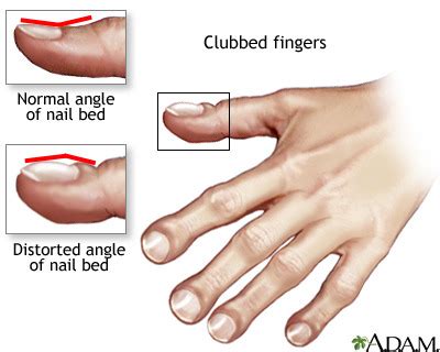 Nursing Health Assessment Chapter 11 Skin Hair And Nails