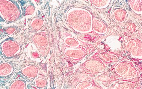 Myelinated Nerve Fiber Histology