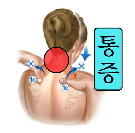 뒷골 두통 뒷머리 통증 제거하려면 네이버 블로그