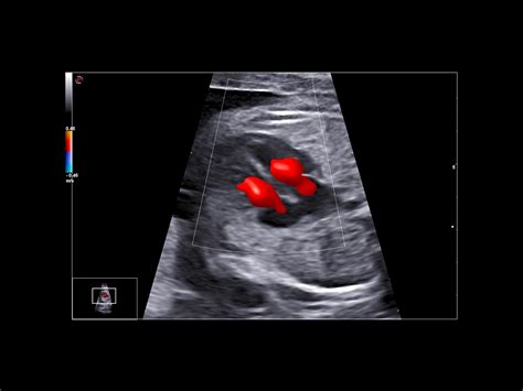 Obstetric Ultrasound Clinical Solutions - Esaote