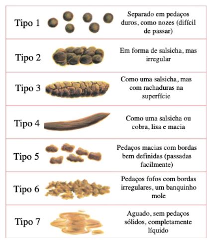 O Que É Constipação Crônica