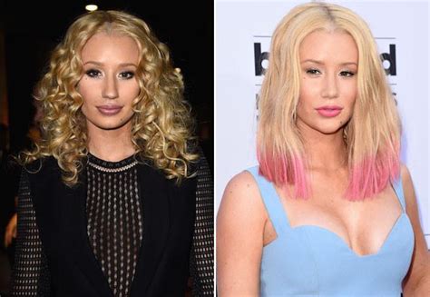 Iggy Azalea Gets Plastic Surgery To Boost Profile But Her Career Is In ...