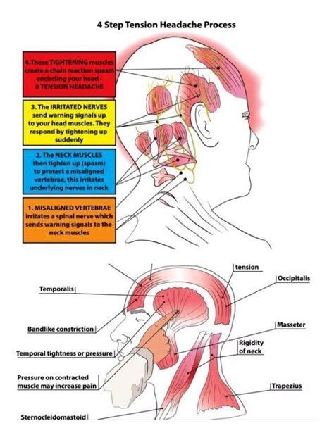 Pressure points on head diagram of the heart – Artofit