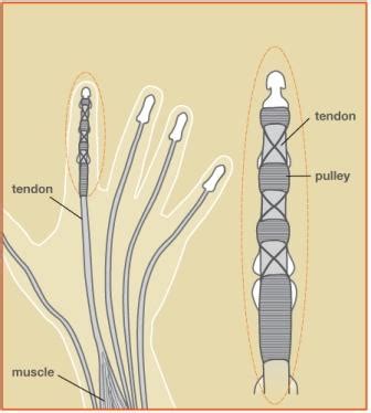 Flexor Tendon Injury Treatment Raleigh Hand | Raleigh Hand to Shoulder ...