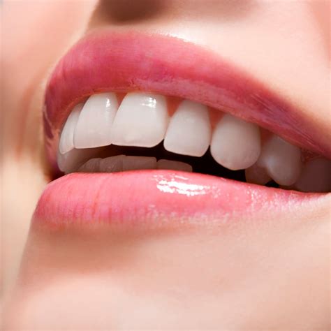 Cleaning Tips For A Beautiful Healthy Smile Kowhai Dental