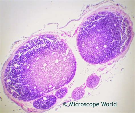 Nerve fibers under the microscope at 40x. http://blog.microscopeworld ...