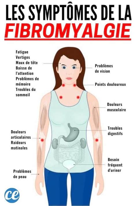 9 Symptômes De La Fibromyalgie Pour Détecter Rapidement Cette Maladie