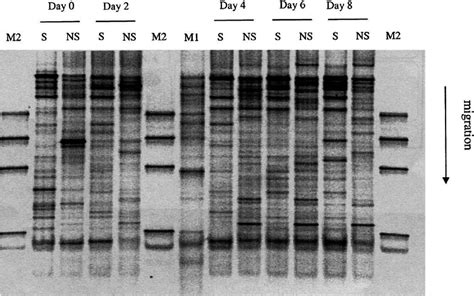 16s Rdnabased Denaturing Gradient Gel Electrophoresis Dgge Profiles Download Scientific