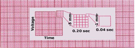 Ecg Graph Paper Cardiac Sciences Manitoba