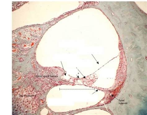 Cochlea Histology Diagram | Quizlet