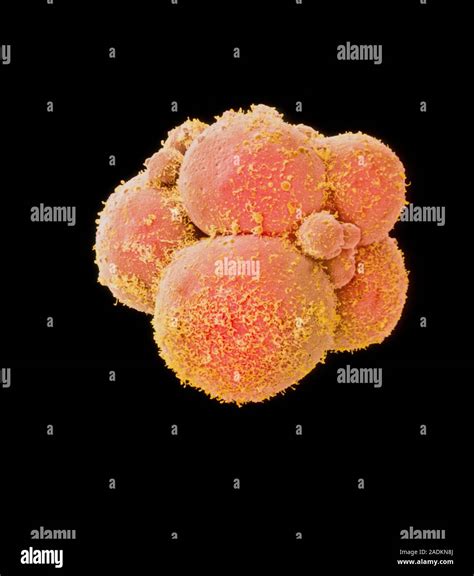 Eight Cell Embryo Coloured Scanning Electron Micrograph Sem Of A